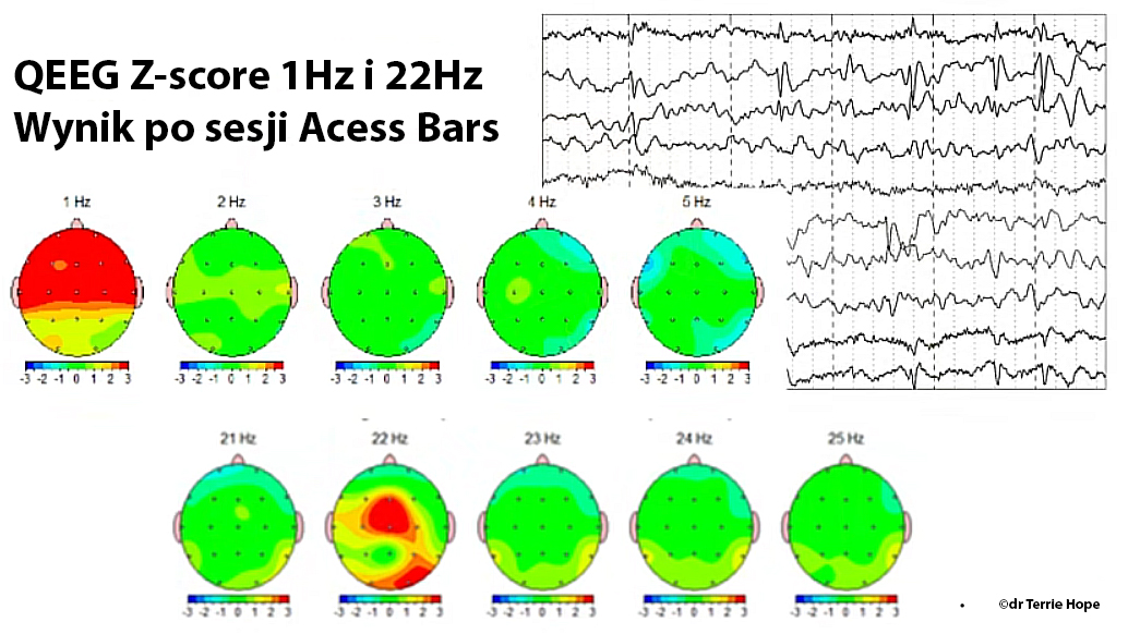 1 i 22 Hz po sesji Bars